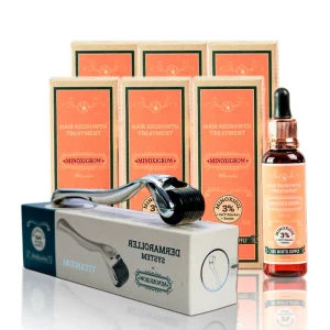alopecia hereditaria