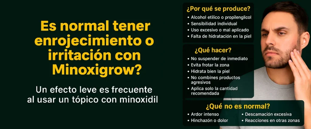 irritación Minoxidil