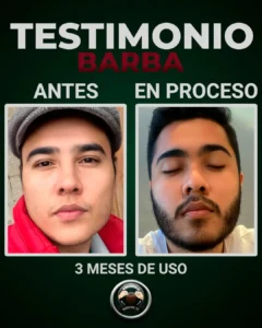 tonico minoxigrow