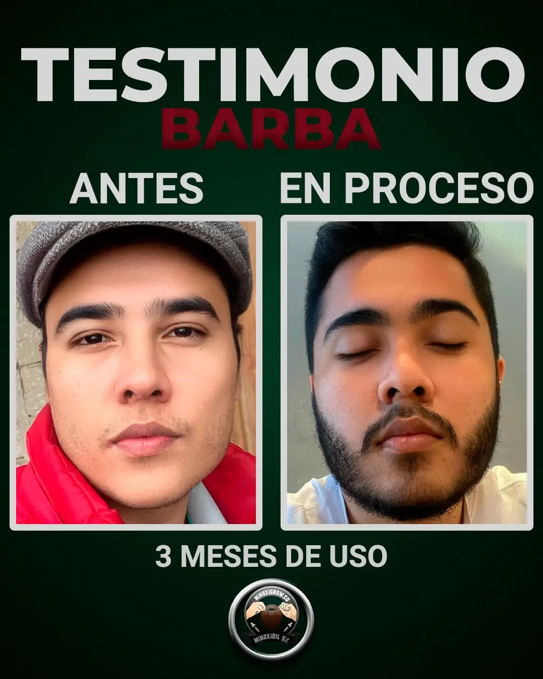 tonico minoxigrow