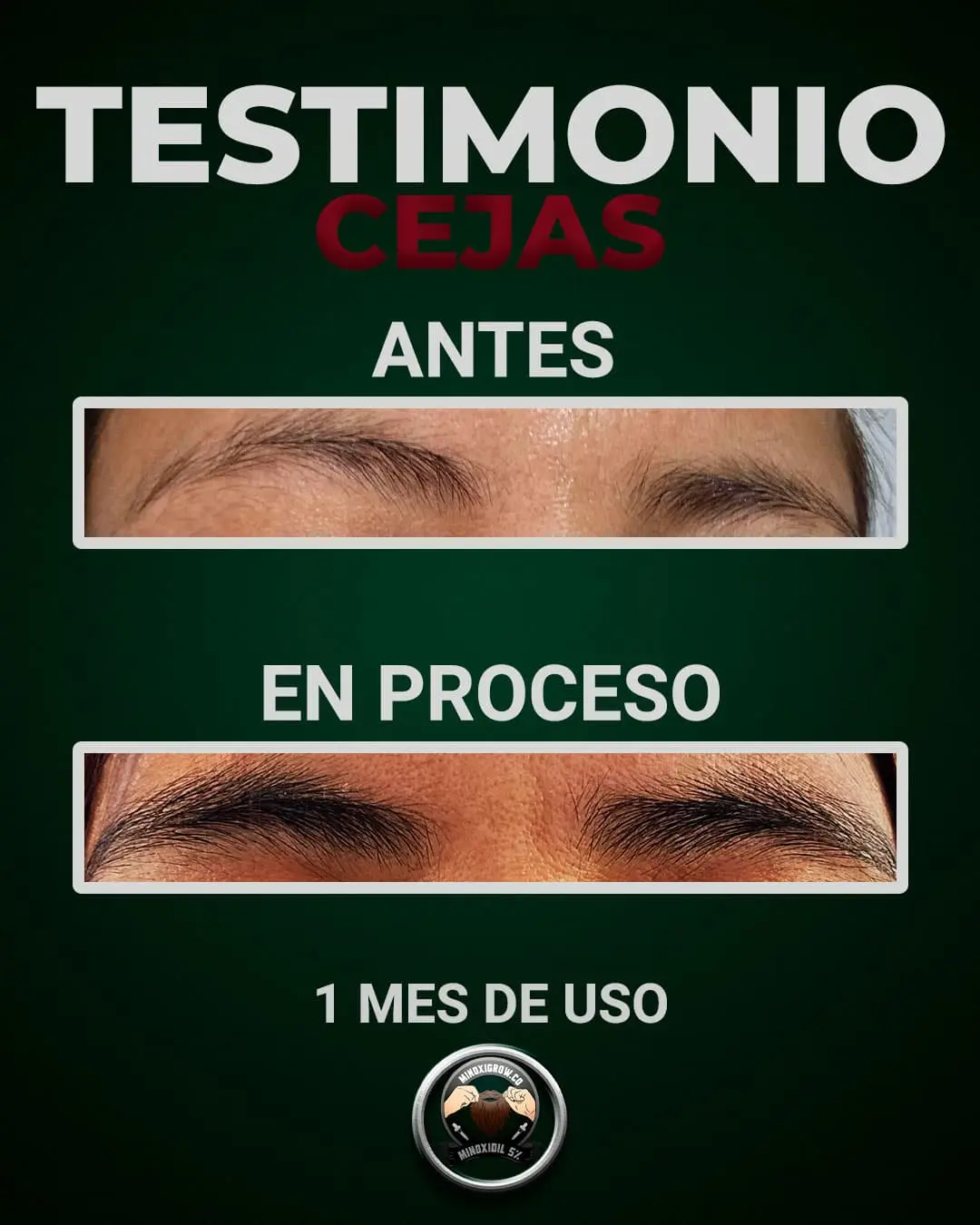 mujer tiene crecimiento considerable en cejas