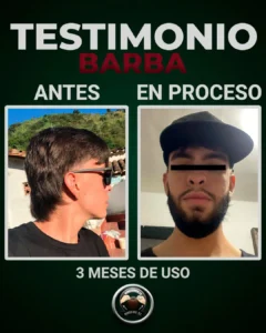 Hombre con barba