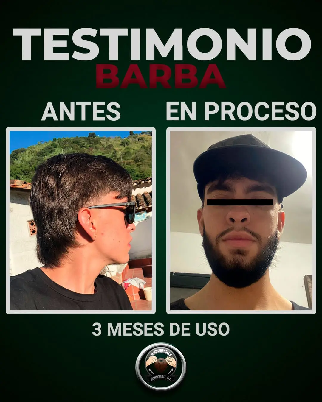 Hombre con barba