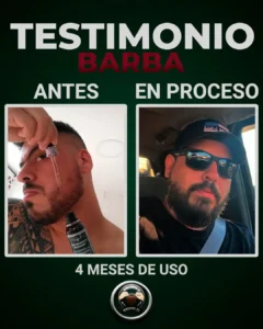 hombre con tonico en las manos lo aplica en barba