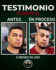 barba antes y despues