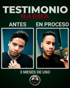 hombre joven con tonico para barba en la mano