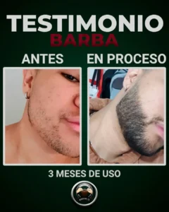 hombre con barba