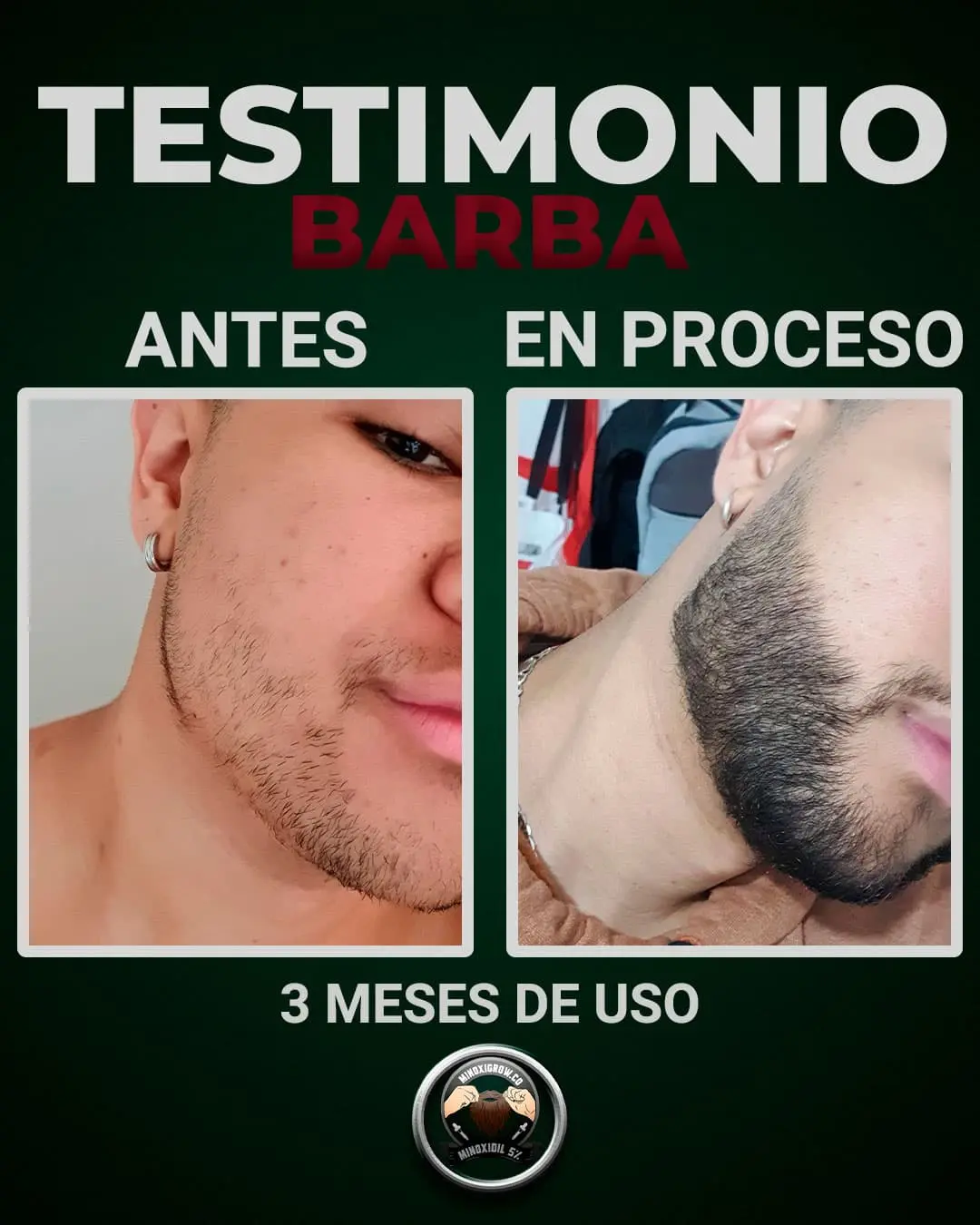 hombre con barba