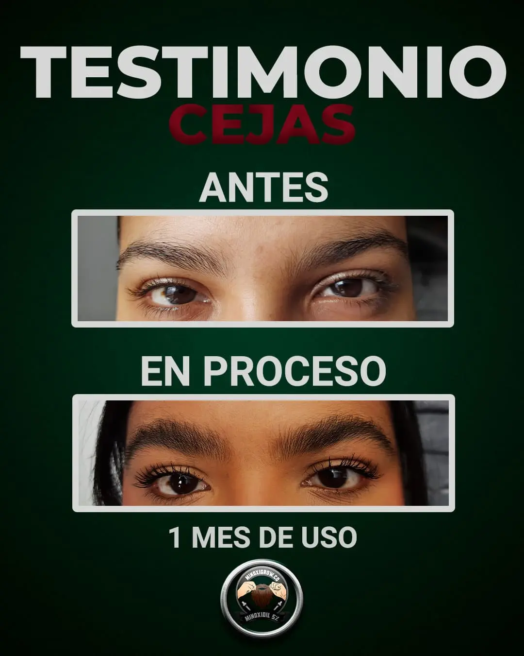 tonico para cejas resultados en 1 mes