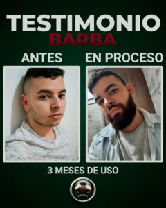 Minoxigrow hombre mostrando sus resultados en barba con el tonico